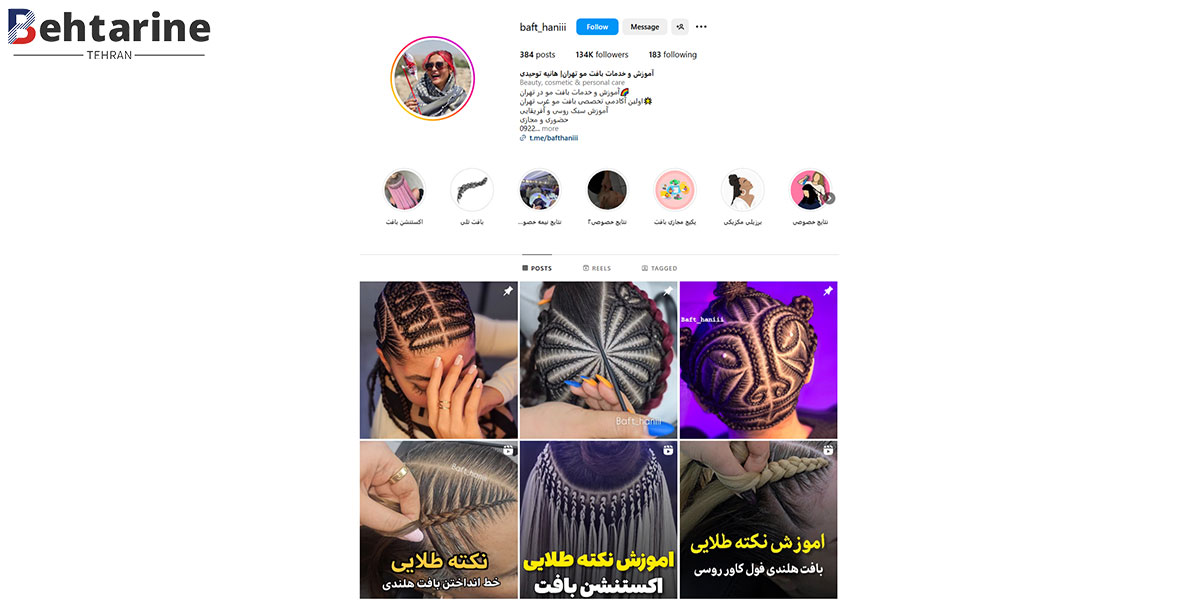 بهترین مرکز بافت مو در تهران