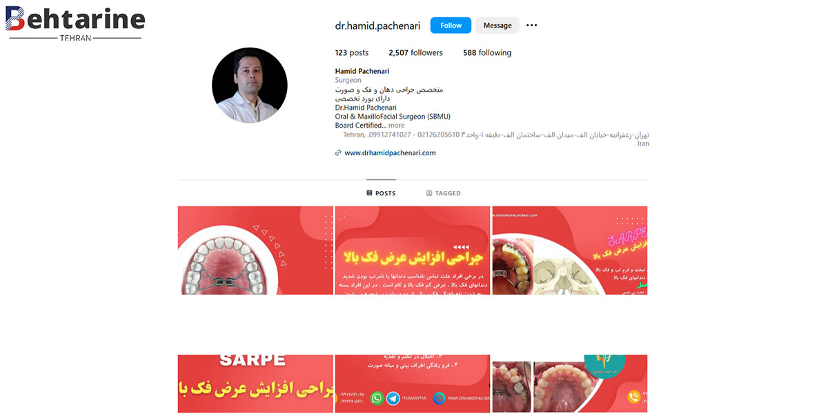 بهترین دکتر بلفاروپلاستی در تهران
