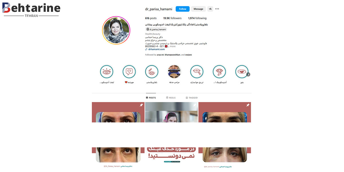 بهترین دکتر بلفاروپلاستی در تهران