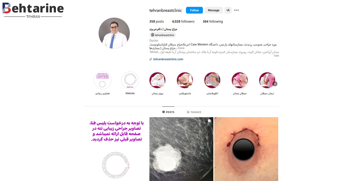 بهترین جراح پروتز سینه در تهران