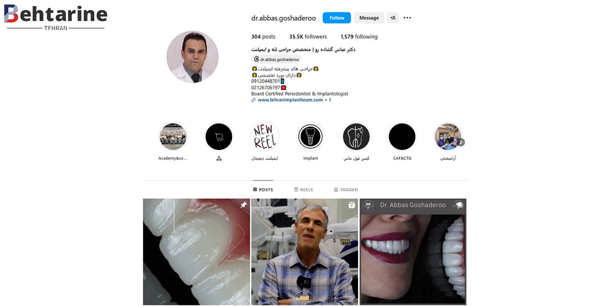 بهترین متخصص ایمپلنت دندان در تهران