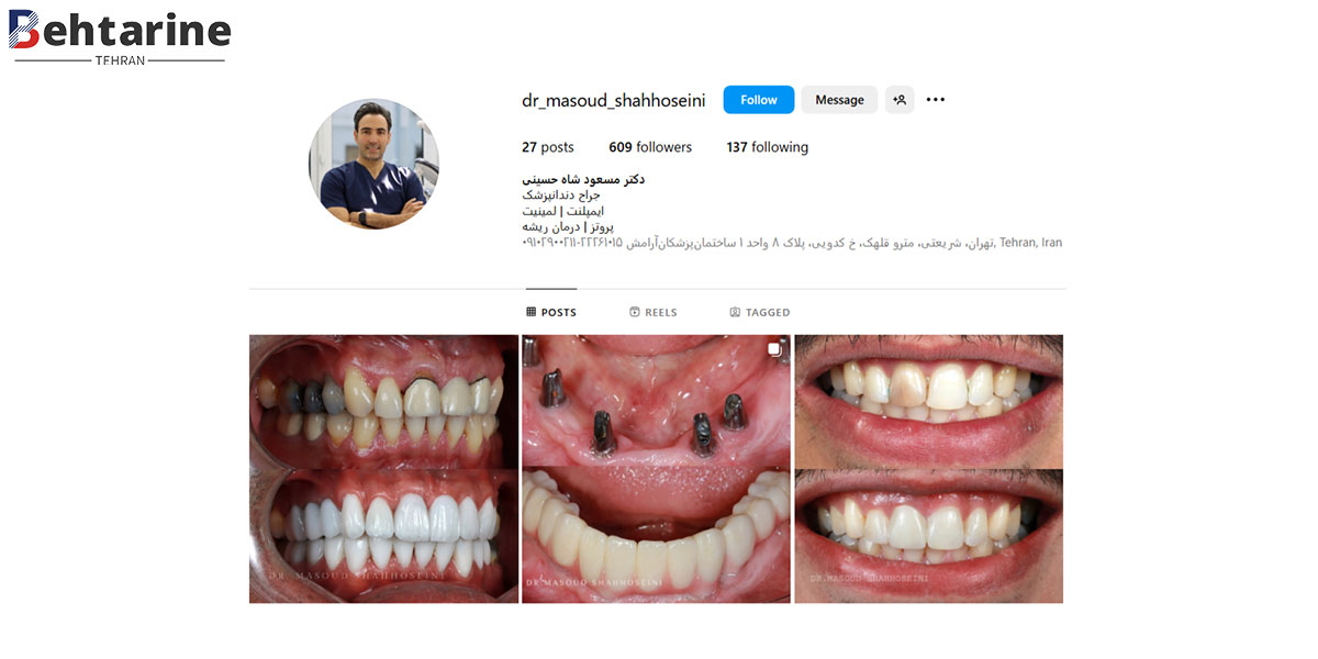 بهترین متخصص ایمپلنت دندان در تهران