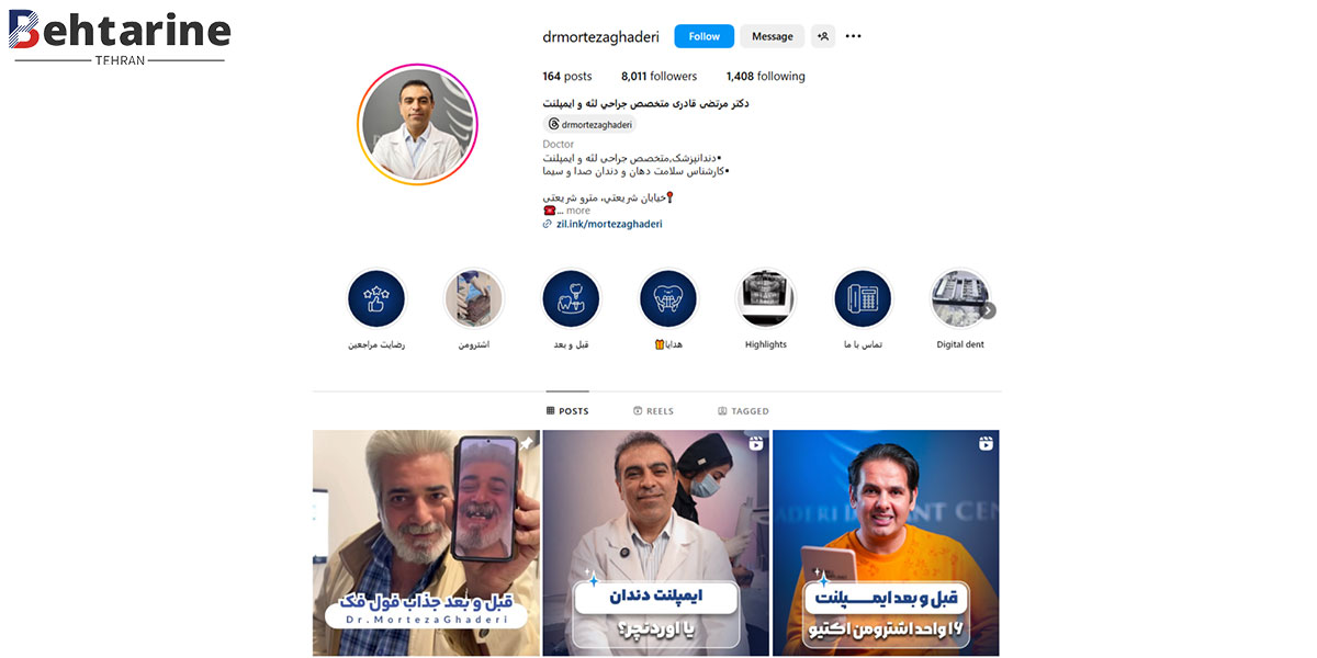 بهترین متخصص ایمپلنت دندان در تهران