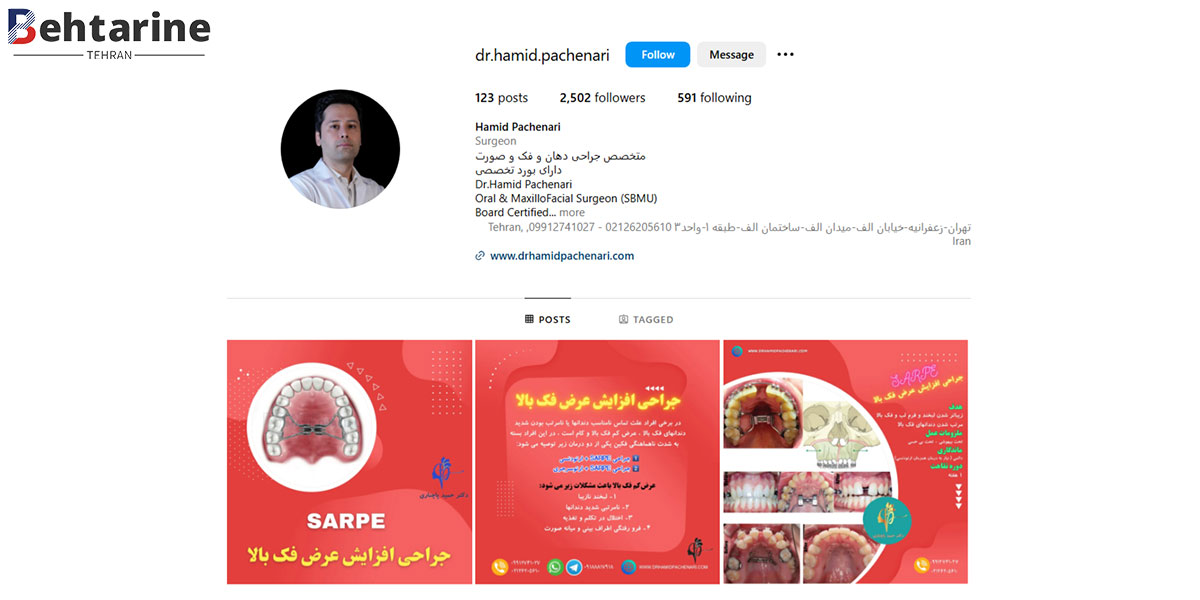 بهترین متخصص ایمپلنت دندان در تهران