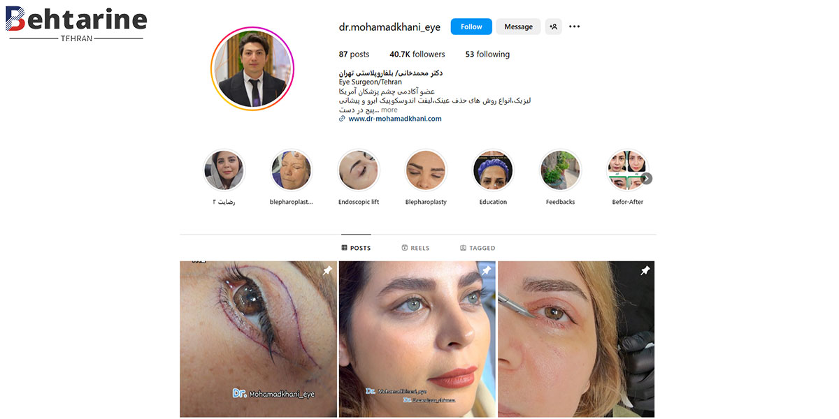 بهترین جراح فمتولیزیک در تهران