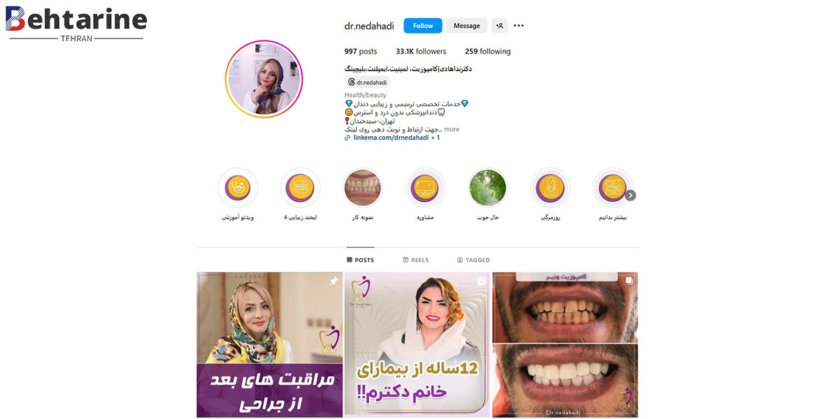 بهترین دکتر کامپوزیت دندان در تهران
