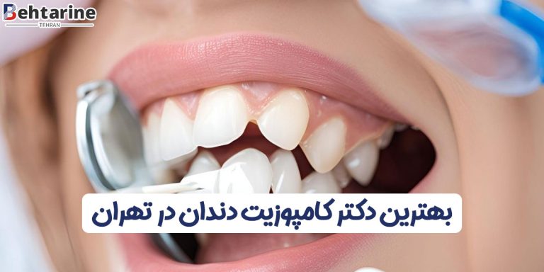 بهترین دکتر کامپوزیت دندان در تهران