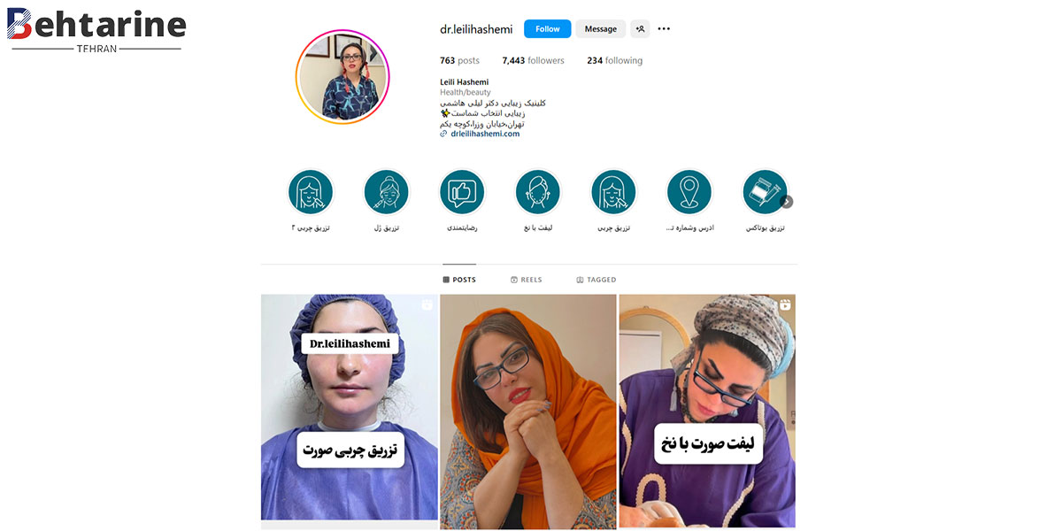بهترین دکتر تزریق ژل لب در تهران