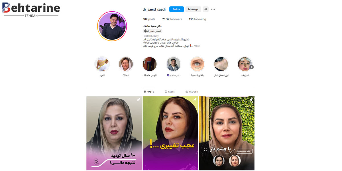 بهترین دکتر تزریق ژل لب در تهران
