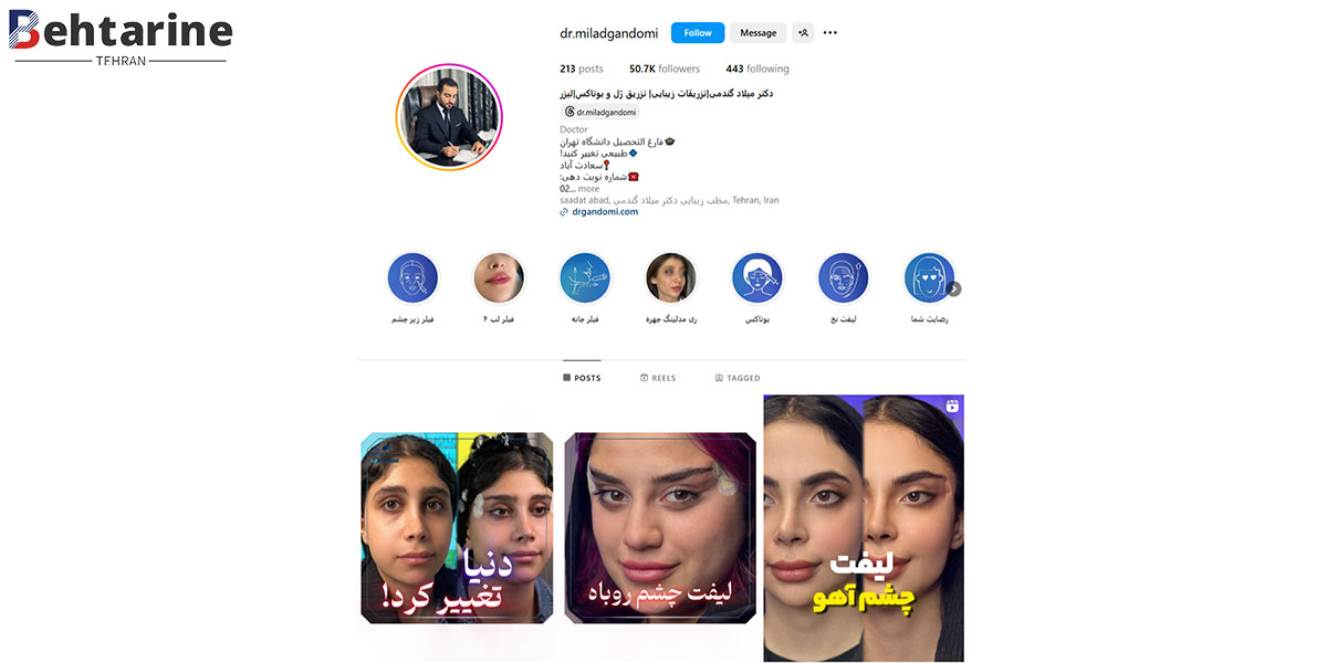 بهترین دکتر تزریق ژل لب در تهران