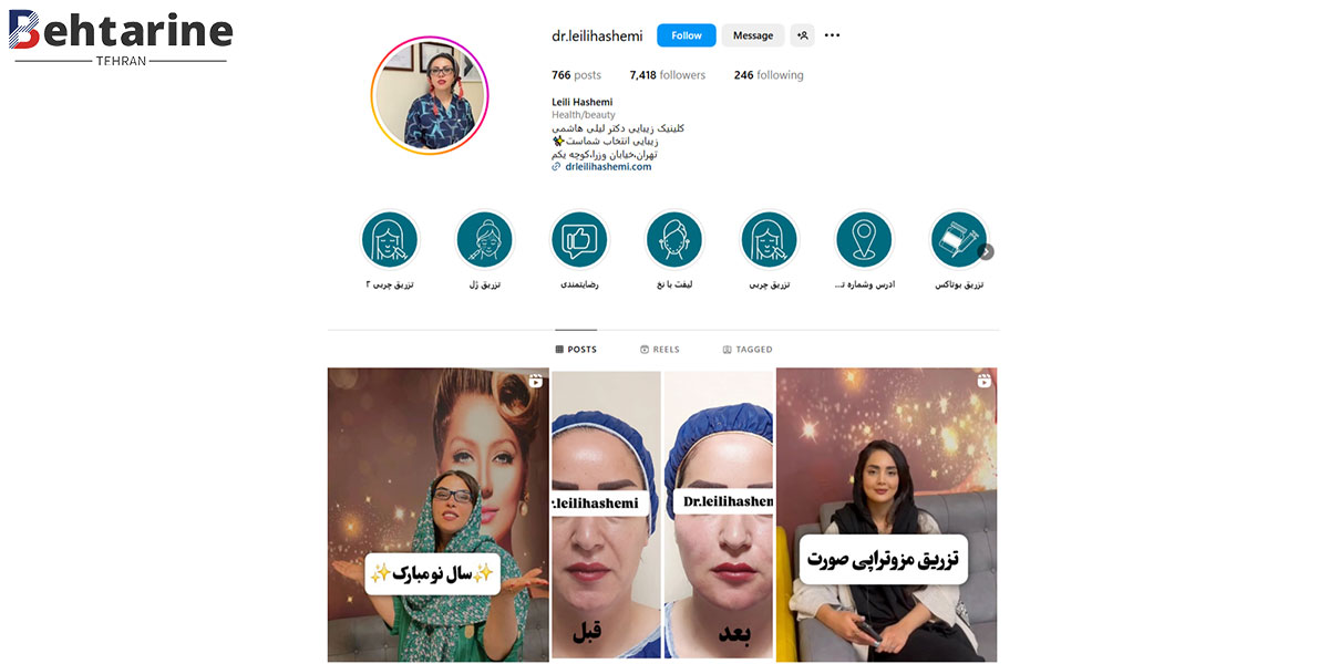 بهترین دکتر تزریق ژل صورت در تهران