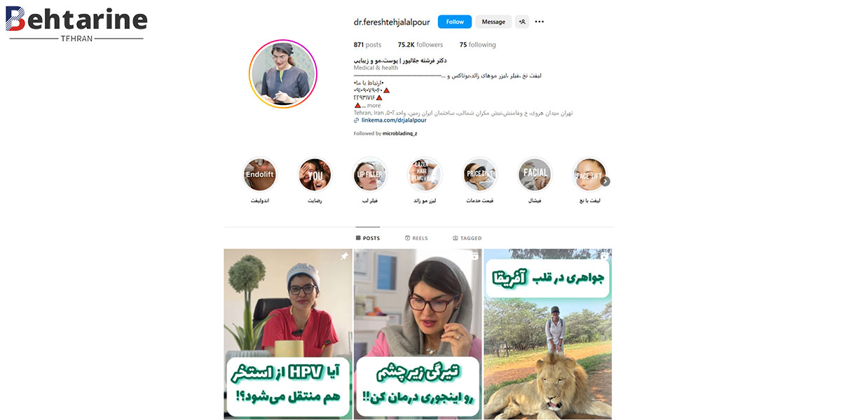 بهترین دکتر تزریق ژل صورت در تهران