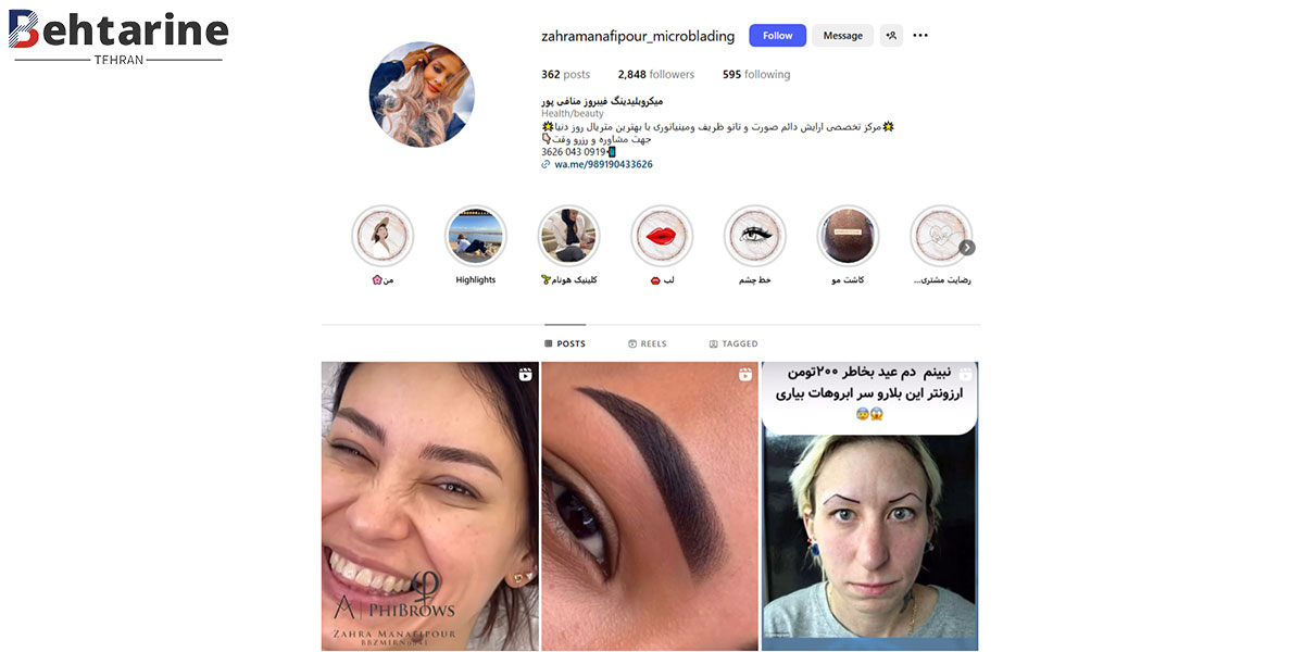 بهترین مرکز میکروبلیدینگ در تهران