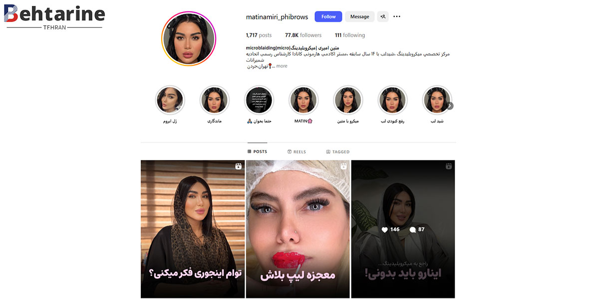 بهترین مرکز میکروبلیدینگ در تهران